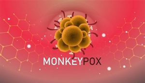 Monkeypox: Health experts hope WHO's public health emergency declaration resets response to 'emerging pandemic'